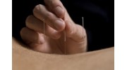 Rupesh Harding Acupuncture