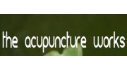 Acupuncture & Acupressure in Newcastle upon Tyne, Tyne and Wear