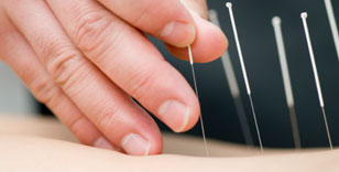 Cahir Doherty- Acupuncture At B-ProActive Healthcare
