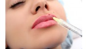 Dermal Fillers
