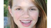 Braces