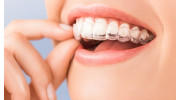 Invisalign
