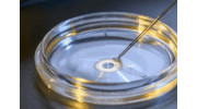 Egg Donation